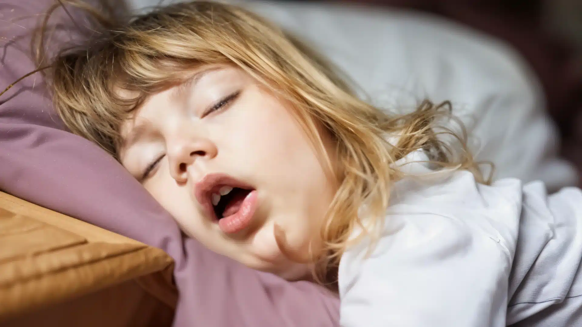 Health Hub 80 Young child sleeping with mouth open on pillow, showing signs of possible snoring or sleep apnea in kids