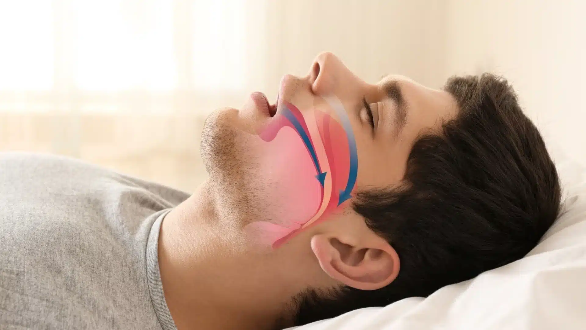 Health Hub 42 Man sleeping with mouth open showing airflow obstruction and sleep apnea illustration